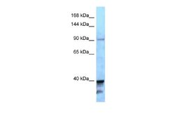 KIF7 Rabbit anti-Human, Polyclonal, Novus Biologicals 0.1ml; Unconjugated:Antibodies,